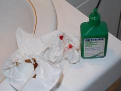 Desinfektionsmittel und blutige Tücher